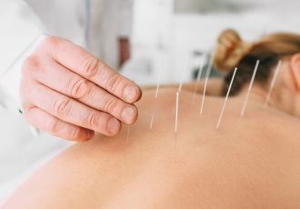 Acupuncture Treatment​